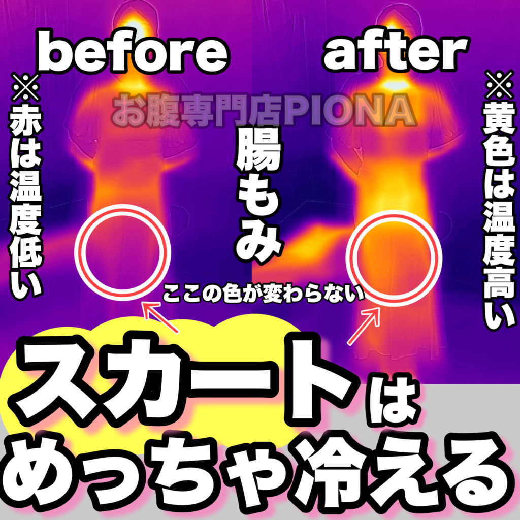 【大阪 腸もみ】冬のスカートはお腹がとても冷える原因